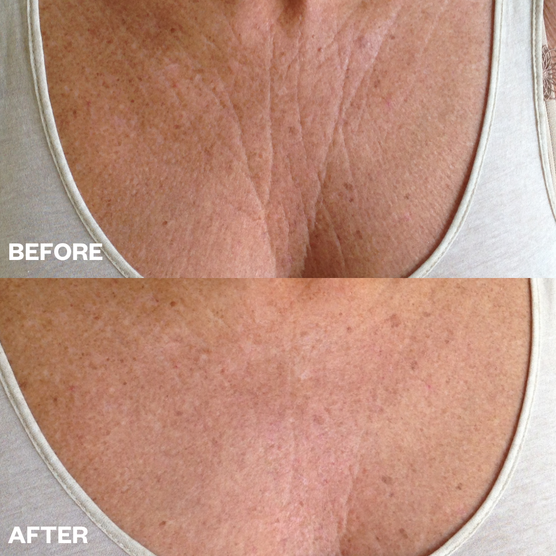 Wrinkles Schminkles Wrinkle Patches